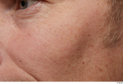 Face Man White Wrinkles Face Skin Textures